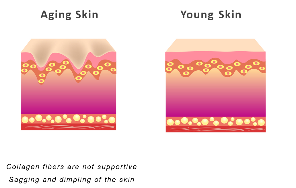Young skin